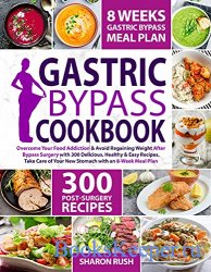 Gastric Bypass Cookbook: Overcome Your Food Addiction & Avoid Regaining Weight After Bypass Surgery with 300 Delicious